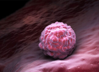Zabieg komórkami macierzystymi